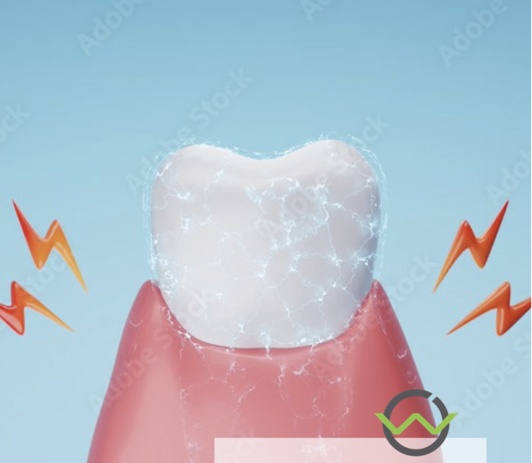 Dentale Hypersensibilität